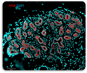 FFPE Human Normal Breast stained with PPIB