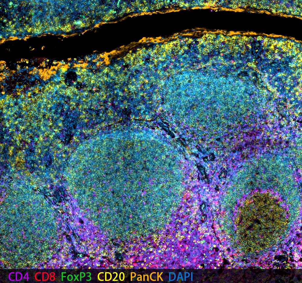 Human FFPE Tonsil 6 color